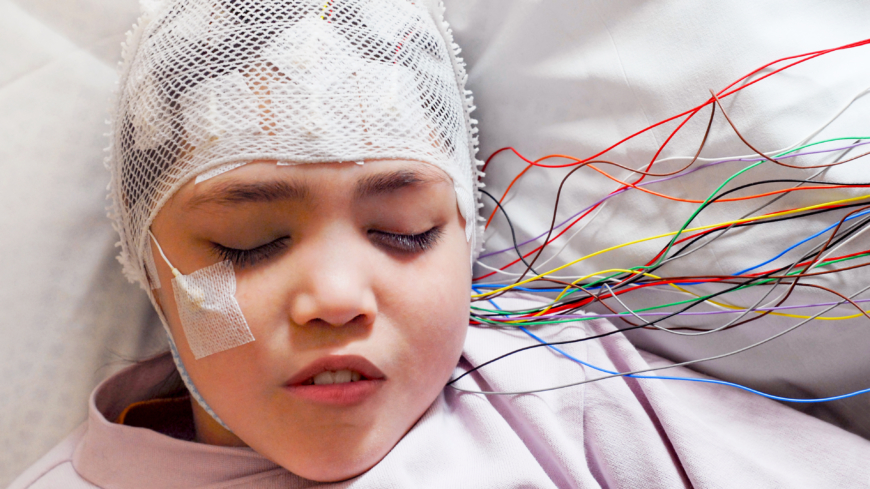Elektroencefalografi (EEG) är en metod för att registrera hjärnbarkens spontana elektriska aktivitet med hjälp av elektroder som vanligtvis klistras fast på skalpen. Foto: Shutterstock